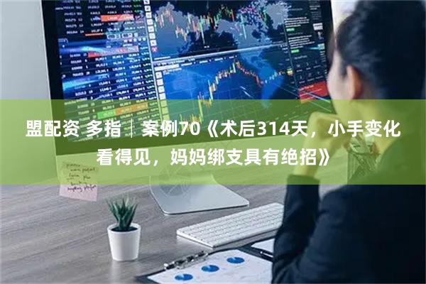 盟配资 多指│案例70《术后314天，小手变化看得见，妈妈绑支具有绝招》